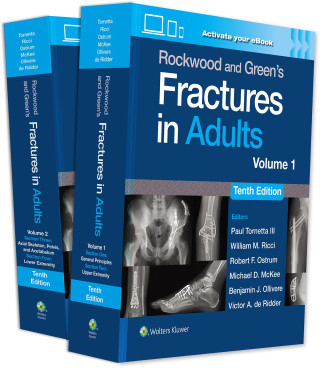 Rockwood and Green's Fractures in Adults: Print + eBook with    Multimedia