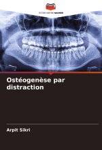 Ostéogen?se par distraction