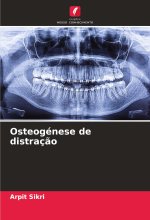 Osteogénese de distraç?o