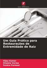 Um Guia Prático para Restauraç?es de Extremidade de Raiz