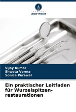 Ein praktischer Leitfaden für Wurzelspitzen- restaurationen