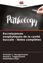Excroissances exophytiques de la cavité buccale - Notes compl?tes