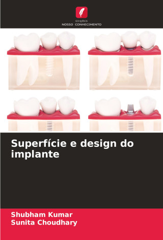 Superfície e design do implante