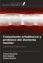 Tratamiento ortodóncico y protésico del diastema maxilar