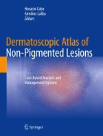 Dermatoscopic Atlas of Non-Pigmented Lesions