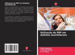 Utilizaç?o de PRP em defeitos maxilofaciais