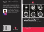 Marcaç?o de água em imagens médicas