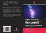 Trauma da medula espinhal no estudo de raios-X, tomografia computadorizada e ressonância magnética