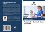 Tuberkulin-Hauttest: Neue Einblicke