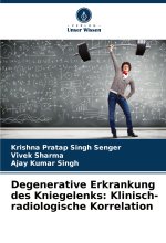 Degenerative Erkrankung des Kniegelenks: Klinisch-radiologische Korrelation