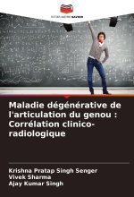 Maladie dégénérative de l'articulation du genou : Corrélation clinico-radiologique
