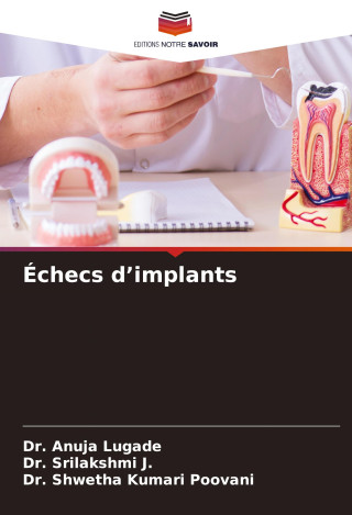 Échecs d?implants