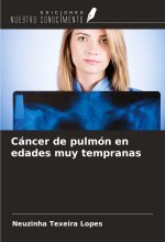 Cáncer de pulmón en edades muy tempranas