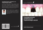 Consideraciones protésicas en implantología dental