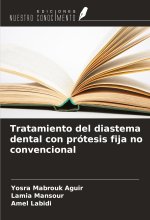 Tratamiento del diastema dental con prótesis fija no convencional