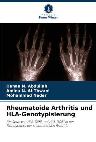 Rheumatoide Arthritis und HLA-Genotypisierung