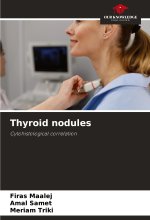 Thyroid nodules