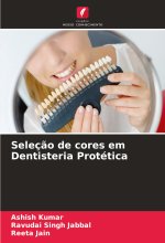 Seleç?o de cores em Dentisteria Protética