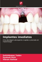 Implantes imediatos