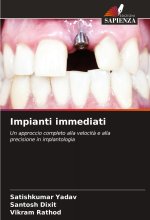 Impianti immediati