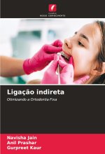 Ligaç?o indireta