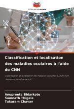 Classification et localisation des maladies oculaires ? l'aide de CNN
