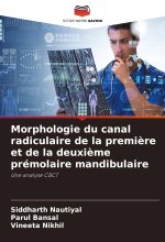 Morphologie du canal radiculaire de la premi?re et de la deuxi?me prémolaire mandibulaire