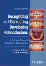 Recognizing and Correcting Developing Malocclusion s: A Problem-Oriented Approach to Orthodontics, Se cond Edition