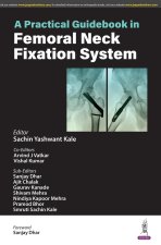Practical Guidebook in Femoral Neck Fixation System