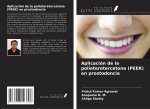 Aplicación de la polieteretercetona (PEEK) en prostodoncia