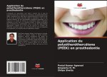 Application du polyétheréthercétone (PEEK) en prosthodontie