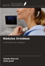 Nódulos tiroideos