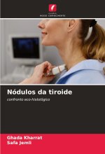 Nódulos da tiroide