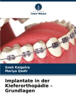 Implantate in der Kieferorthopädie ? Grundlagen