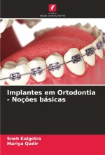 Implantes em Ortodontia - Noç?es básicas