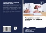 Rasprostranennost' celiakii pri cirroze pecheni
