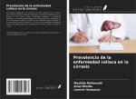 Prevalencia de la enfermedad celíaca en la cirrosis