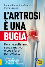 artrosi è una bugia. Perché soffriamo senza motivo e cosa fare per evitarlo