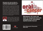 Marqueurs du sous-sol dans la muqueuse buccale normale et le carcinome épidermoïde buccal