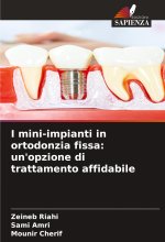 I mini-impianti in ortodonzia fissa: un'opzione di trattamento affidabile