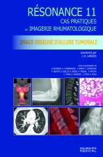 Résonance 11 - Imagerie osseuse d'allure tumorale