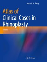 Atlas of Clinical Cases in Rhinoplasty