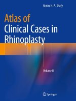 Atlas of Clinical Cases in Rhinoplasty