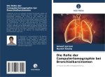 Die Rolle der Computertomographie bei Bronchialkarzinomen