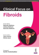 Clinical Focus on Fibroids