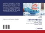Simultaneous Retraction and Intrusion of Maxillary Anterior Teeth