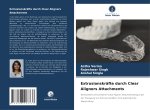 Extrusionskräfte durch Clear Aligners Attachments