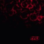 OSI  BLOOD BLACK LTD.