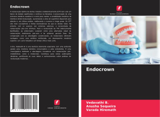 Endocrown