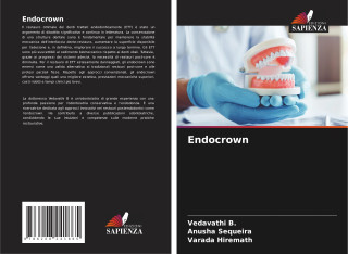 Endocrown